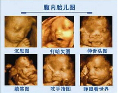 贵阳市四维彩超